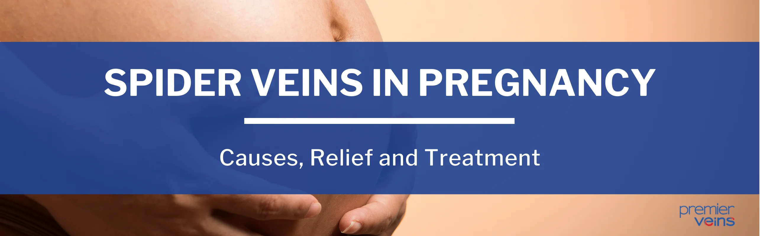 A guide to spider veins in pregnancy