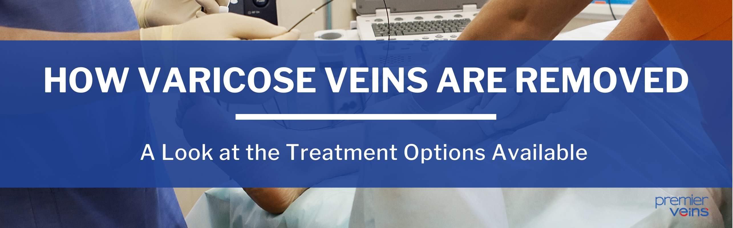 How Varicose Veins Are Removed